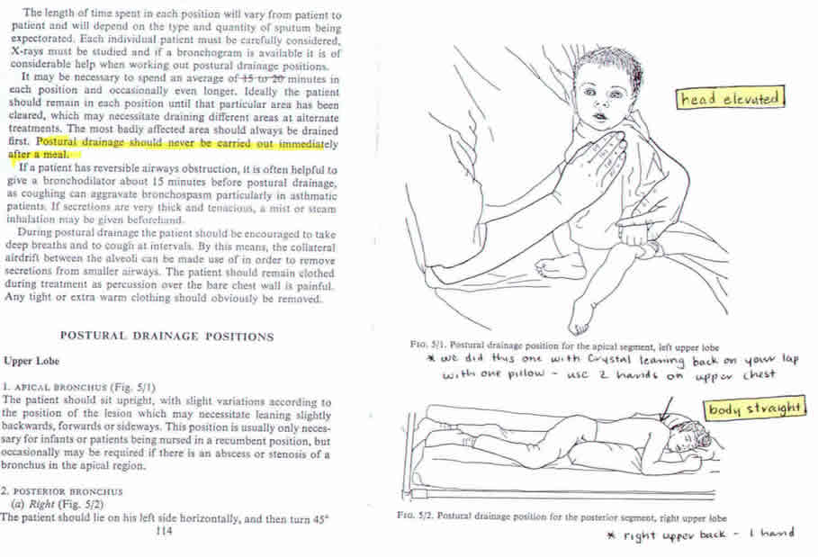 chest physio